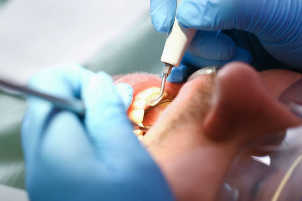 Best Broken Tooth Emergency  in Fairburn, GA